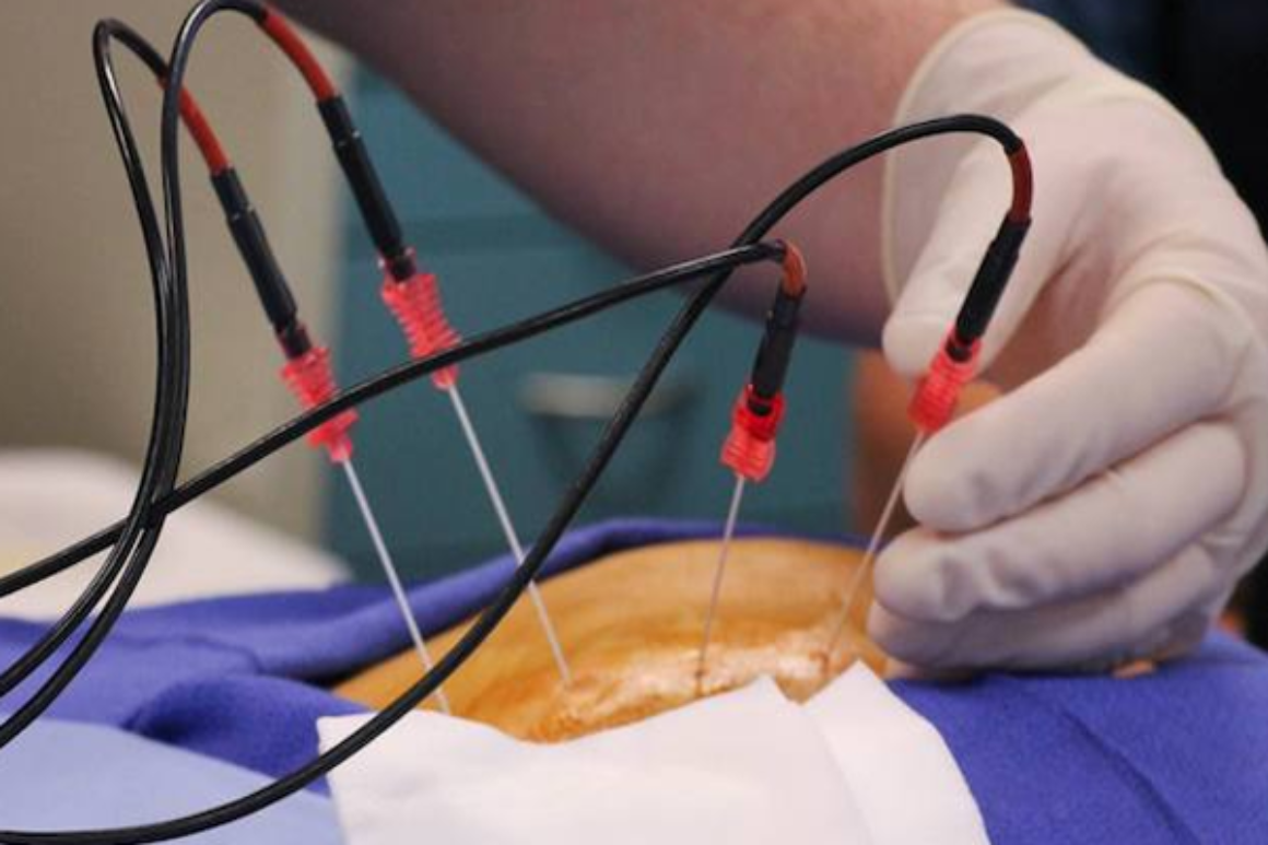 Brandon Pain Clinic Sidhom M.D.